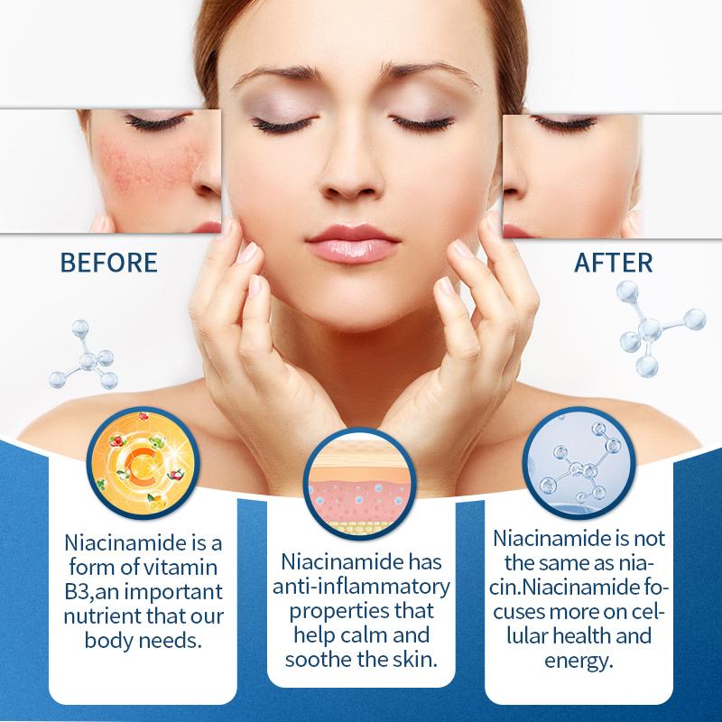 BUNKKA Nicotinamide 500mg Vitamin B3 Supplement for Skin Brightening Anti-Aging Energy Focus Support Fine Line Smoothing