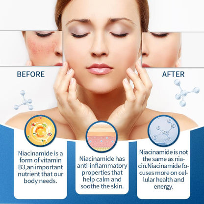 BUNKKA Nicotinamide 500mg Vitamin B3 Supplement for Skin Brightening Anti-Aging Energy Focus Support Fine Line Smoothing